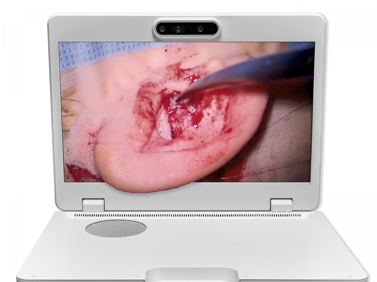 达擎之＂Heads-up 3D显微手术显示系统＂，整合4K裸眼3D显示及眼球追踪系统，具备快速追踪人眼移动位置功能，减轻医师长时间维持固定姿势的负担，让医师能有更宽广清晰的3D立体视野及更舒适的姿势来执行手术。